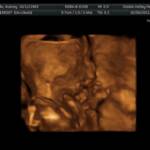 20 weeks - hand near face