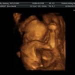 20 weeks - flexing his bony arms!