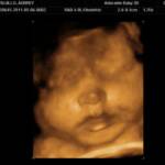 33 weeks - 3D!