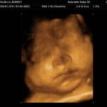 33 weeks - 3D!