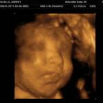 33 weeks - 3D!