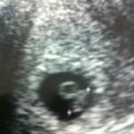 6 weeks, 4 days 

Aubrey's thoughts: I think it looks like me already! :)