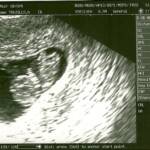 9 weeks, 4 days

We got to see our little one's heartbeat that day!  This is all starting to feel so real....